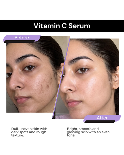 VITAMIN C SERUM