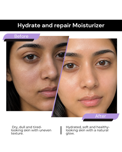 HYDRATE & REPAIR MOISTURIZER